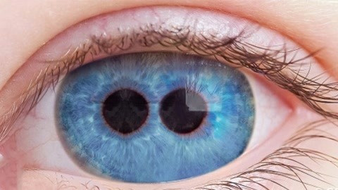 1%的人才有的特征, 一只眼睛两个瞳孔?你中了几个?