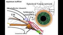 Episcleral Venous Fluid Wave, Canal-based Glaucoma Surgery